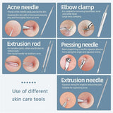 Facial Cleansing & Care Tools Acne Blackhead Stainless Steel Removal Kit