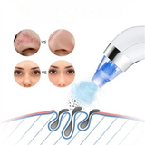 Electric Blackhead Remover Vacuum for Facial Beauty